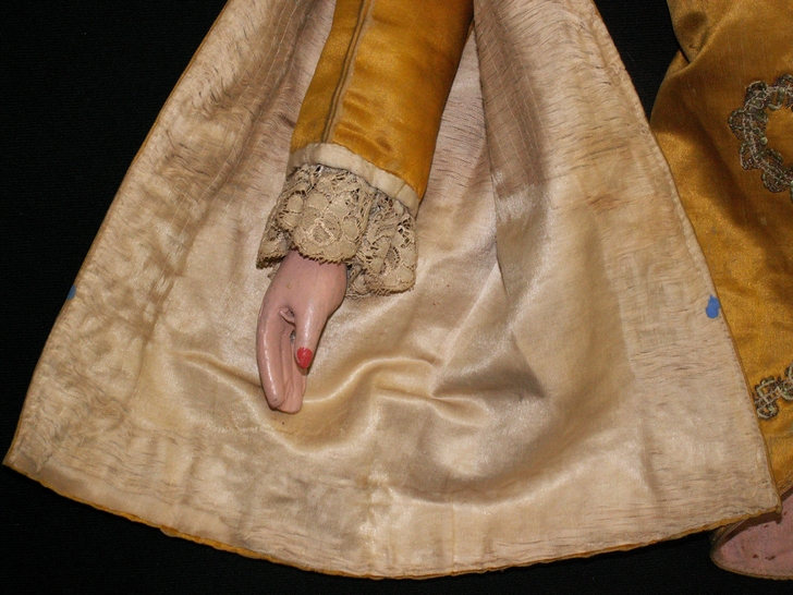 Manica destra dopo il restauro